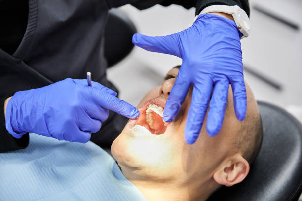 Best Emergency Treatment for Oral Infections in Chattahoochee, FL